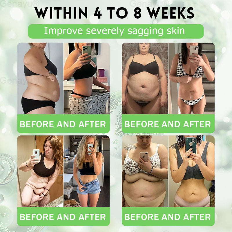 2026 New & Upgraded: 90% OFF ✅ 𝑫𝑶𝑻𝑨𝑳𝑬® Lymphatic Drainage Slimming Nano-Microneedle Patch: Ultra-Potent 5× Formula with Lipolytic Peptide Complex — Supports Weight Loss & Lymphatic Flow — Plus Joint Relief, Better Sleep & Mental Clarity