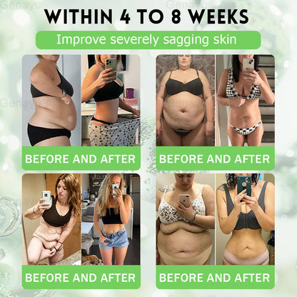 2026 New & Upgraded: 90% OFF ✅ 𝑫𝑶𝑻𝑨𝑳𝑬® Lymphatic Drainage Slimming Nano-Microneedle Patch: Ultra-Potent 5× Formula with Lipolytic Peptide Complex — Supports Weight Loss & Lymphatic Flow — Plus Joint Relief, Better Sleep & Mental Clarity