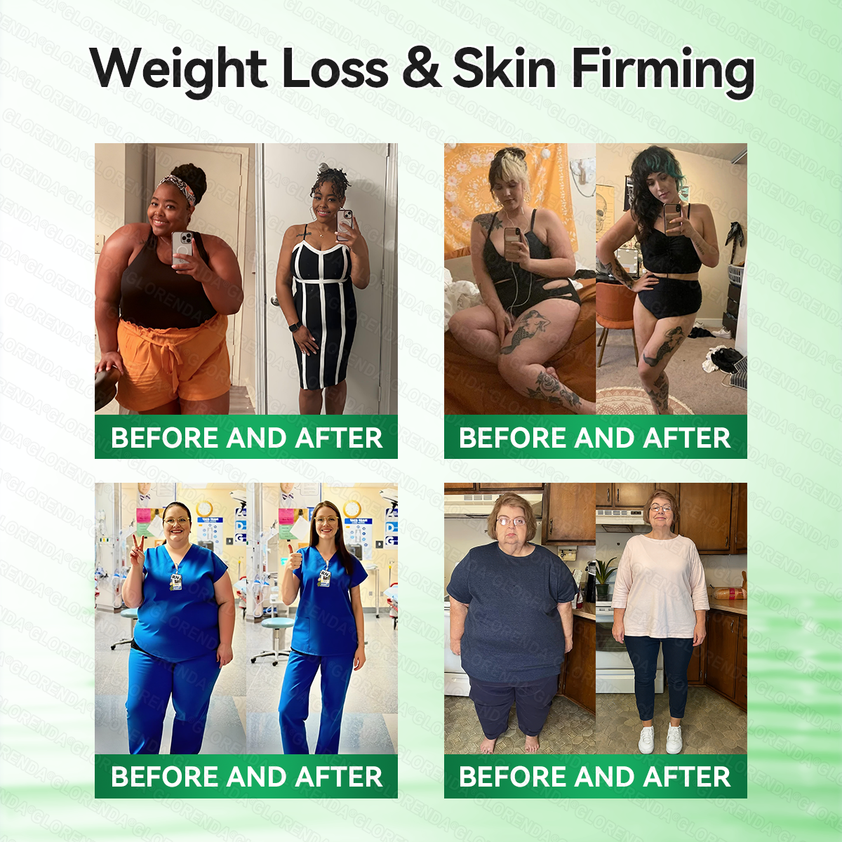 𝑶𝒇𝒇𝒊𝒄𝒊𝒂𝒍 𝑺𝒕𝒐𝒓𝒆  |🍀𝐂𝐚𝐫𝐞𝐔𝐩𝐥𝐢𝐟𝐭® 𝑴𝒆𝒕𝒂𝒃𝒐𝒍𝒊𝒄 𝑵𝒂𝒏𝒐 𝑴𝒊𝒄𝒓𝒐𝒏𝒆𝒆𝒅𝒍𝒆 𝑷𝒂𝒕𝒄𝒉🇺🇸(𝐉𝐮𝐬𝐭 𝐨𝐧𝐜𝐞 𝐚 𝐝𝐚𝐲, 𝐯𝐢𝐬𝐢𝐛𝐥𝐞 𝐜𝐡𝐚𝐧𝐠𝐞𝐬 𝐢𝐧 𝟕 𝐝𝐚𝐲𝐬）𝘽𝙚𝙧𝙗𝙚𝙧𝙞𝙣𝙚 + 𝙈𝙤𝙧𝙞𝙣𝙜𝙖 𝙁𝙤𝙧𝙢𝙪𝙡𝙖 ✅ 𝐅𝐨𝐫 𝐨𝐛𝐞𝐬𝐢𝐭𝐲, 𝗟𝗼𝗼𝘀𝗲 𝘀𝗸𝗶𝗻,𝐝𝐢𝐚𝐛𝐞𝐭𝐞𝐬, 𝐬𝐥𝐞𝐞𝐩 𝐚𝐩𝐧𝐞𝐚, 𝐣𝐨𝐢𝐧𝐭 𝐢𝐬𝐬𝐮𝐞𝐬, 𝐚𝐧𝐝 𝐦𝐨𝐫𝐞💯
