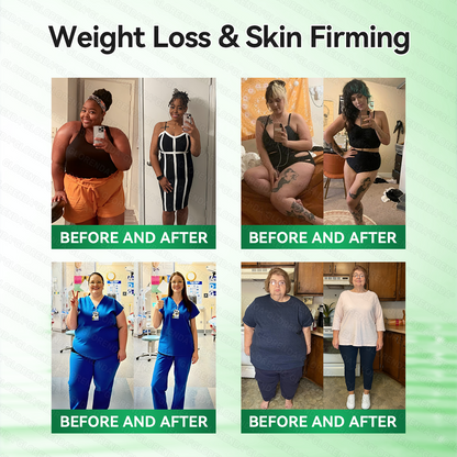 𝑶𝒇𝒇𝒊𝒄𝒊𝒂𝒍 𝑺𝒕𝒐𝒓𝒆  |🍀𝐂𝐚𝐫𝐞𝐔𝐩𝐥𝐢𝐟𝐭® 𝑴𝒆𝒕𝒂𝒃𝒐𝒍𝒊𝒄 𝑵𝒂𝒏𝒐 𝑴𝒊𝒄𝒓𝒐𝒏𝒆𝒆𝒅𝒍𝒆 𝑷𝒂𝒕𝒄𝒉🇺🇸(𝐉𝐮𝐬𝐭 𝐨𝐧𝐜𝐞 𝐚 𝐝𝐚𝐲, 𝐯𝐢𝐬𝐢𝐛𝐥𝐞 𝐜𝐡𝐚𝐧𝐠𝐞𝐬 𝐢𝐧 𝟕 𝐝𝐚𝐲𝐬）𝘽𝙚𝙧𝙗𝙚𝙧𝙞𝙣𝙚 + 𝙈𝙤𝙧𝙞𝙣𝙜𝙖 𝙁𝙤𝙧𝙢𝙪𝙡𝙖 ✅ 𝐅𝐨𝐫 𝐨𝐛𝐞𝐬𝐢𝐭𝐲, 𝗟𝗼𝗼𝘀𝗲 𝘀𝗸𝗶𝗻,𝐝𝐢𝐚𝐛𝐞𝐭𝐞𝐬, 𝐬𝐥𝐞𝐞𝐩 𝐚𝐩𝐧𝐞𝐚, 𝐣𝐨𝐢𝐧𝐭 𝐢𝐬𝐬𝐮𝐞𝐬, 𝐚𝐧𝐝 𝐦𝐨𝐫𝐞💯