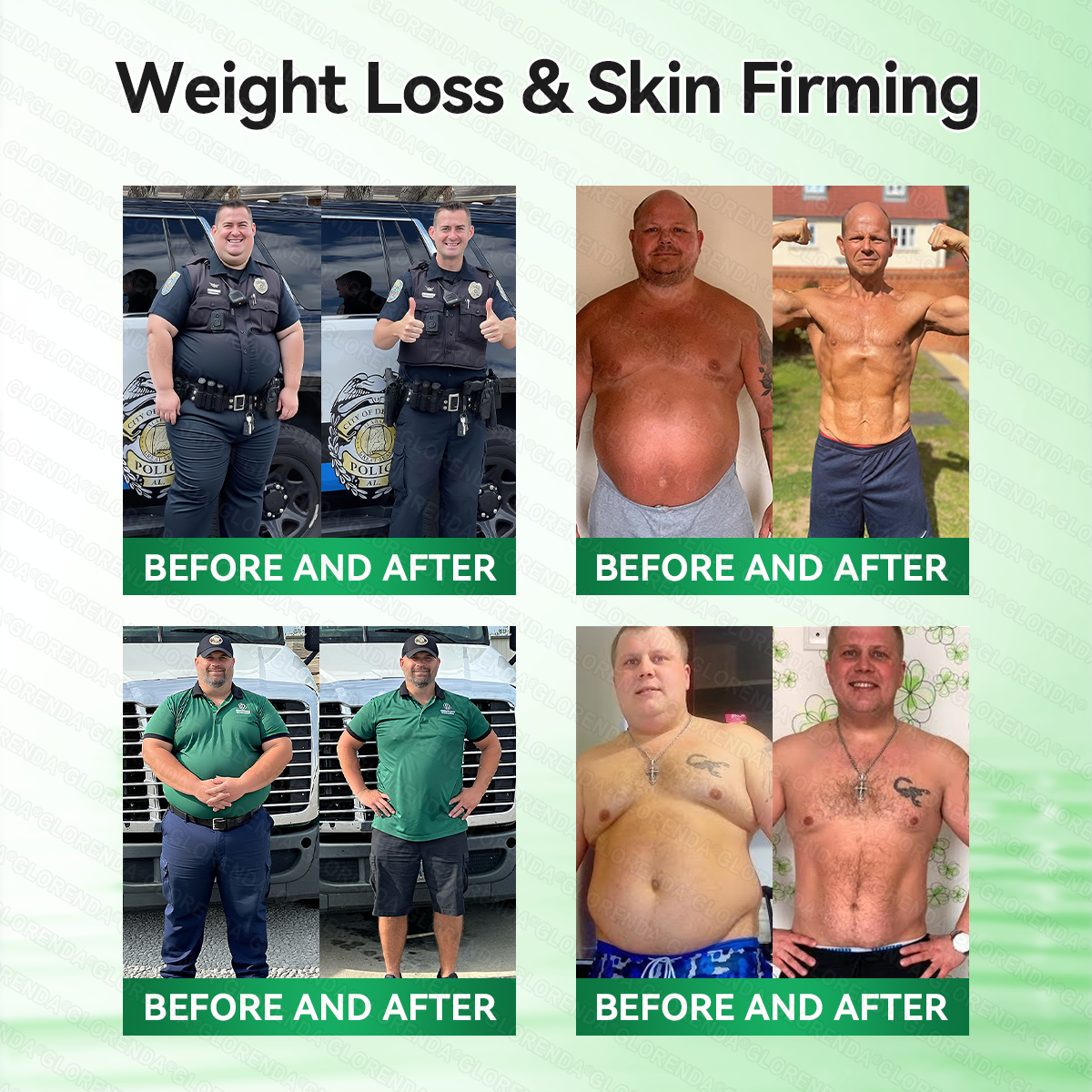 𝑶𝒇𝒇𝒊𝒄𝒊𝒂𝒍 𝑺𝒕𝒐𝒓𝒆  |🍀𝐂𝐚𝐫𝐞𝐔𝐩𝐥𝐢𝐟𝐭® 𝑴𝒆𝒕𝒂𝒃𝒐𝒍𝒊𝒄 𝑵𝒂𝒏𝒐 𝑴𝒊𝒄𝒓𝒐𝒏𝒆𝒆𝒅𝒍𝒆 𝑷𝒂𝒕𝒄𝒉🇺🇸(𝐉𝐮𝐬𝐭 𝐨𝐧𝐜𝐞 𝐚 𝐝𝐚𝐲, 𝐯𝐢𝐬𝐢𝐛𝐥𝐞 𝐜𝐡𝐚𝐧𝐠𝐞𝐬 𝐢𝐧 𝟕 𝐝𝐚𝐲𝐬）𝘽𝙚𝙧𝙗𝙚𝙧𝙞𝙣𝙚 + 𝙈𝙤𝙧𝙞𝙣𝙜𝙖 𝙁𝙤𝙧𝙢𝙪𝙡𝙖 ✅ 𝐅𝐨𝐫 𝐨𝐛𝐞𝐬𝐢𝐭𝐲, 𝗟𝗼𝗼𝘀𝗲 𝘀𝗸𝗶𝗻,𝐝𝐢𝐚𝐛𝐞𝐭𝐞𝐬, 𝐬𝐥𝐞𝐞𝐩 𝐚𝐩𝐧𝐞𝐚, 𝐣𝐨𝐢𝐧𝐭 𝐢𝐬𝐬𝐮𝐞𝐬, 𝐚𝐧𝐝 𝐦𝐨𝐫𝐞💯