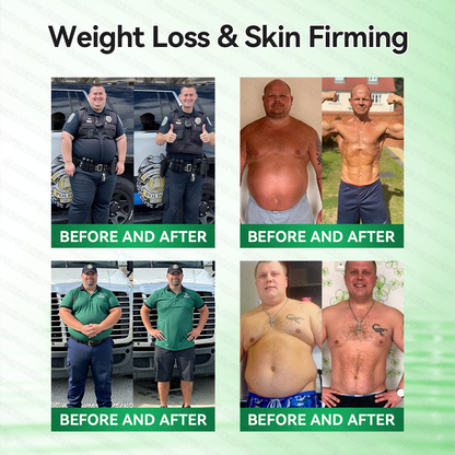 𝑶𝒇𝒇𝒊𝒄𝒊𝒂𝒍 𝑺𝒕𝒐𝒓𝒆  |🍀𝐂𝐚𝐫𝐞𝐔𝐩𝐥𝐢𝐟𝐭® 𝑴𝒆𝒕𝒂𝒃𝒐𝒍𝒊𝒄 𝑵𝒂𝒏𝒐 𝑴𝒊𝒄𝒓𝒐𝒏𝒆𝒆𝒅𝒍𝒆 𝑷𝒂𝒕𝒄𝒉🇺🇸(𝐉𝐮𝐬𝐭 𝐨𝐧𝐜𝐞 𝐚 𝐝𝐚𝐲, 𝐯𝐢𝐬𝐢𝐛𝐥𝐞 𝐜𝐡𝐚𝐧𝐠𝐞𝐬 𝐢𝐧 𝟕 𝐝𝐚𝐲𝐬）𝘽𝙚𝙧𝙗𝙚𝙧𝙞𝙣𝙚 + 𝙈𝙤𝙧𝙞𝙣𝙜𝙖 𝙁𝙤𝙧𝙢𝙪𝙡𝙖 ✅ 𝐅𝐨𝐫 𝐨𝐛𝐞𝐬𝐢𝐭𝐲, 𝗟𝗼𝗼𝘀𝗲 𝘀𝗸𝗶𝗻,𝐝𝐢𝐚𝐛𝐞𝐭𝐞𝐬, 𝐬𝐥𝐞𝐞𝐩 𝐚𝐩𝐧𝐞𝐚, 𝐣𝐨𝐢𝐧𝐭 𝐢𝐬𝐬𝐮𝐞𝐬, 𝐚𝐧𝐝 𝐦𝐨𝐫𝐞💯
